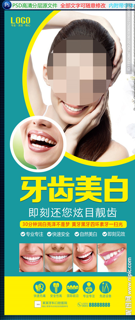 牙齿美白