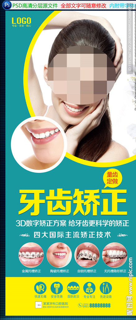 牙齿矫正