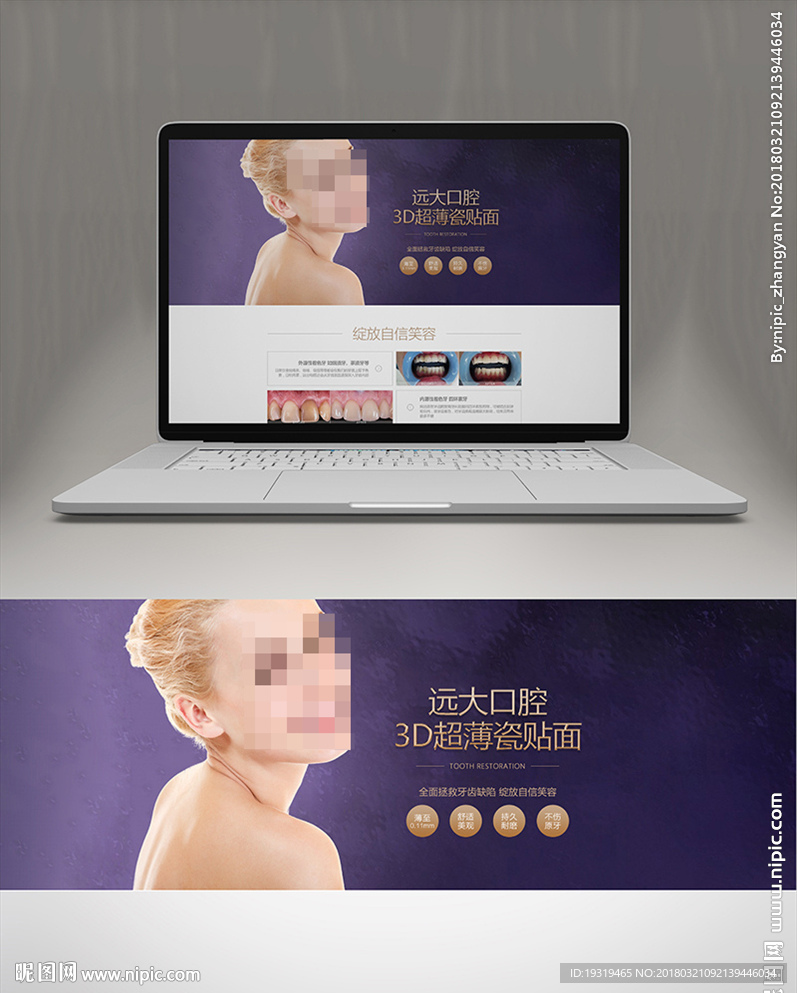 口腔牙科瓷贴面banner