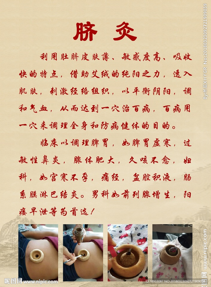 脐灸
