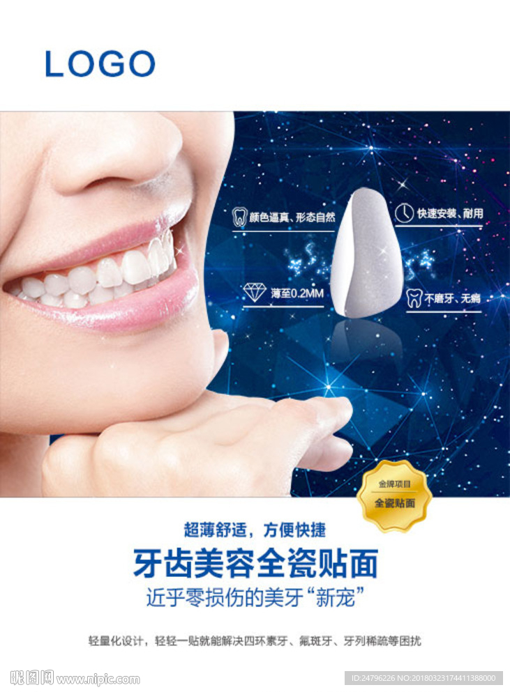 全瓷贴面