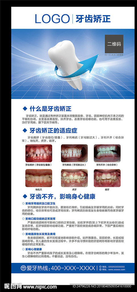 牙齿矫正展架