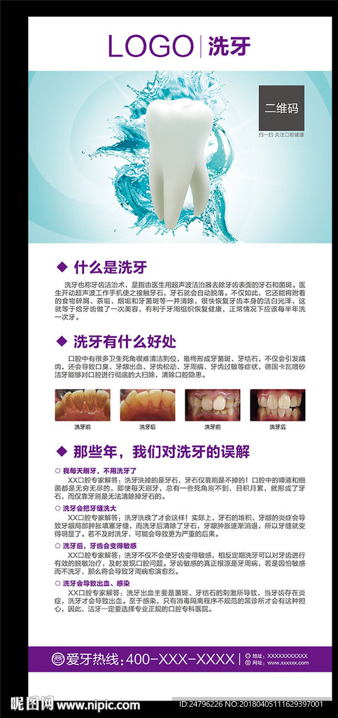 洗牙展架
