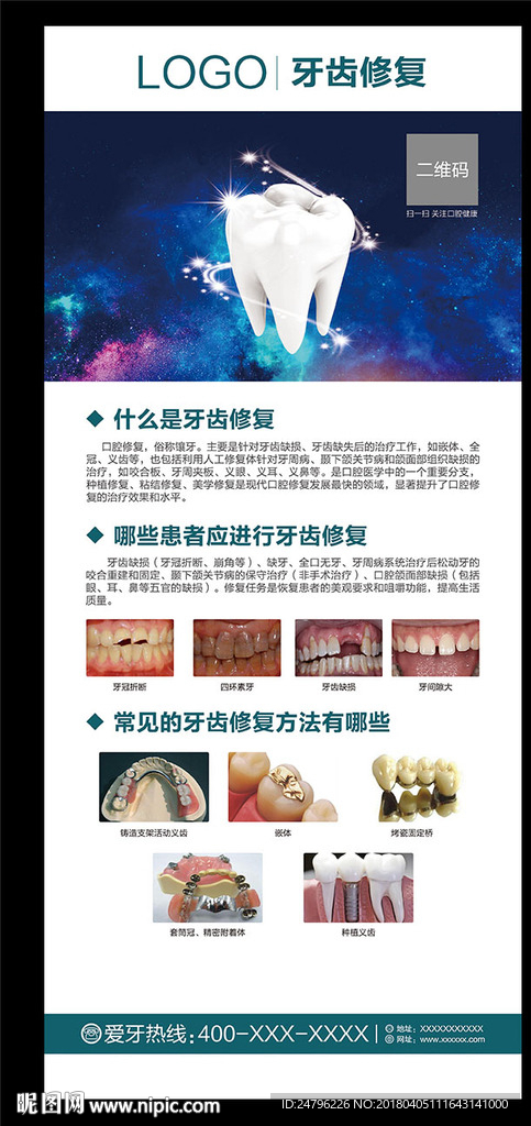 牙齿修复展架