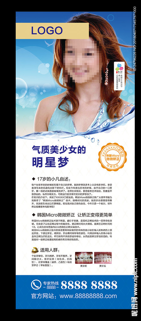 牙齿矫正微微矫正