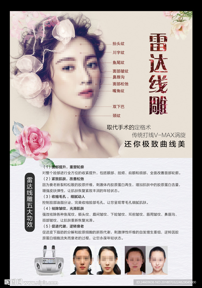 雷达线雕五大功效海报