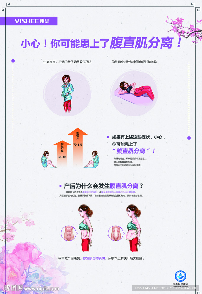 产后修复盆底康复海报