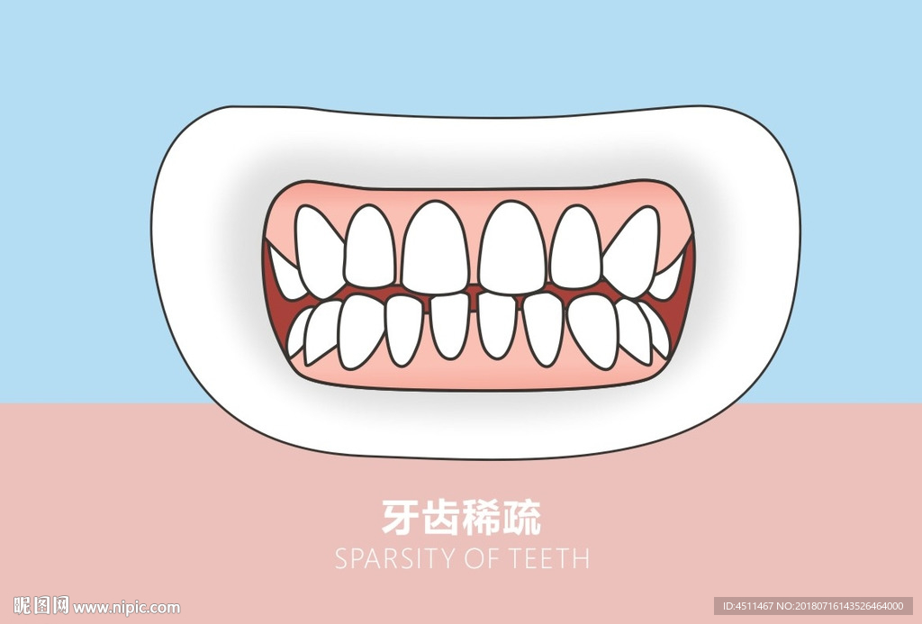 口腔图-牙齿稀疏系列
