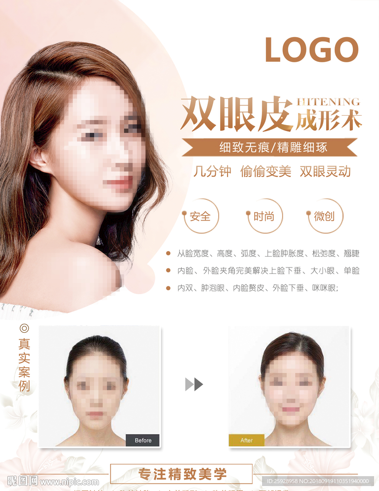 双眼皮对比图