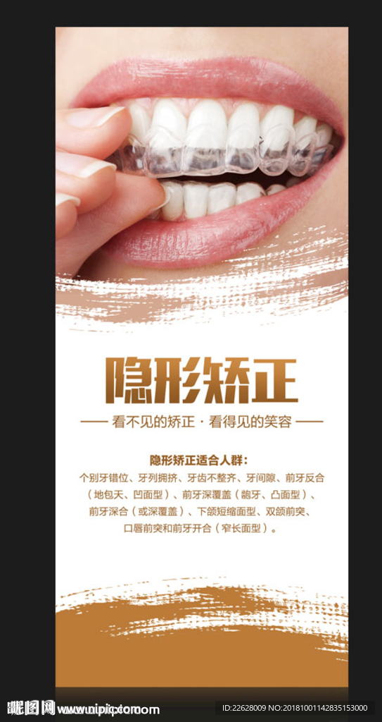 隐形矫正海报