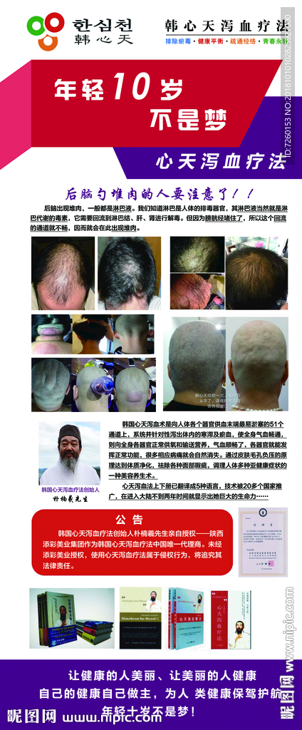 韩国天心泻血疗法展架