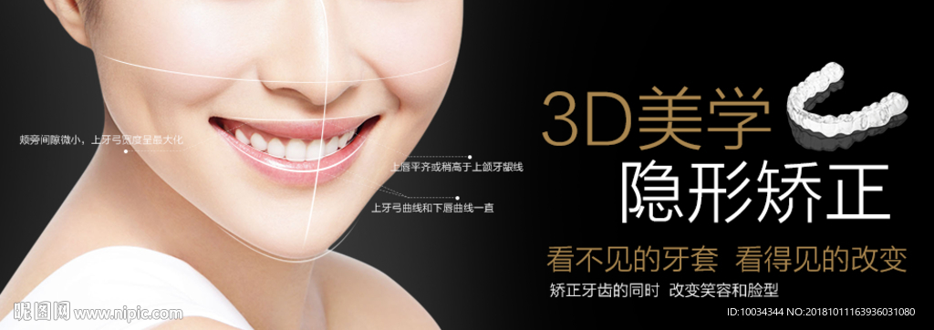 牙齿矫正banner