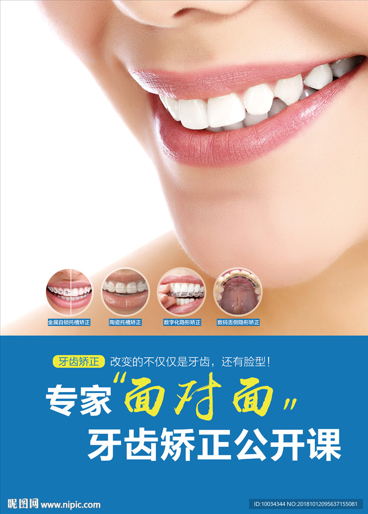 牙齿矫正