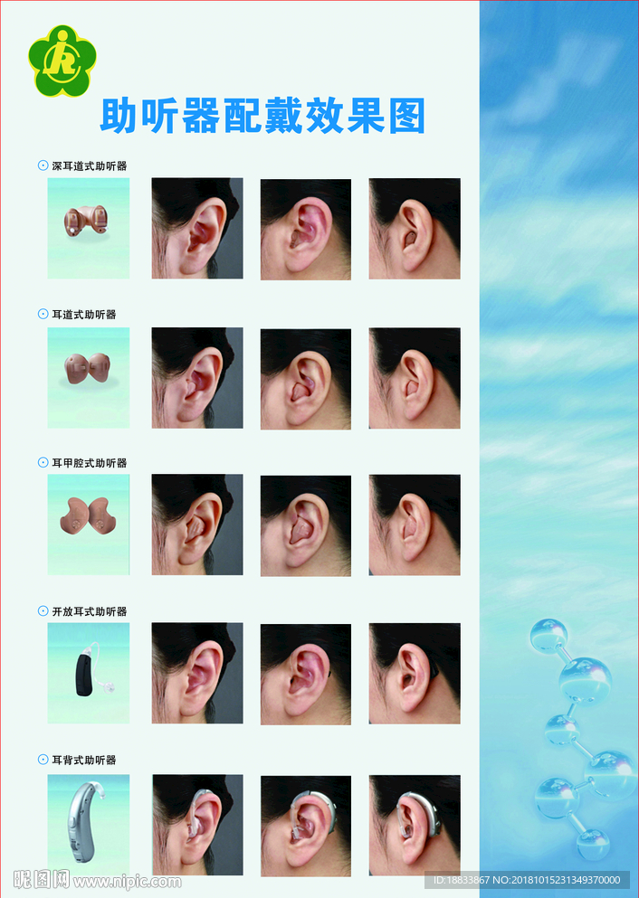 助听器配戴效果图深耳耳道耳甲开