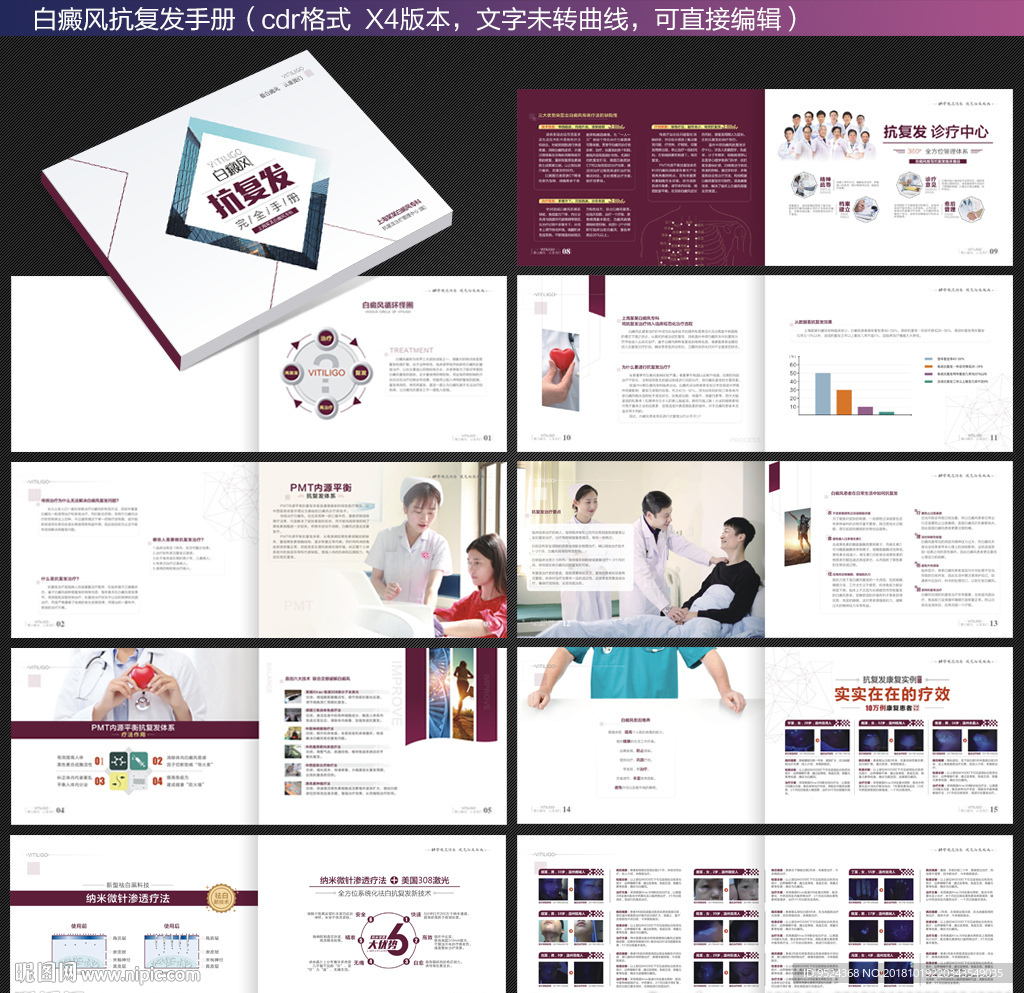 白癜风抗复发手册