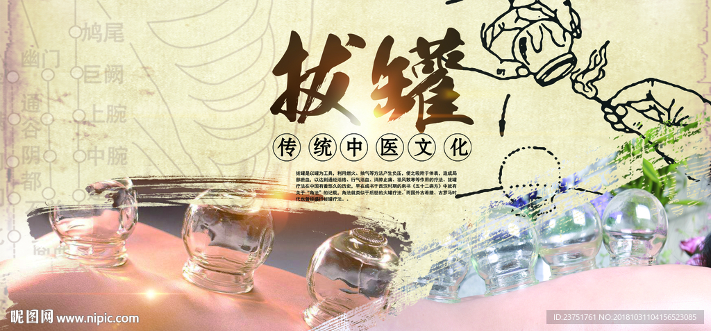 拔罐