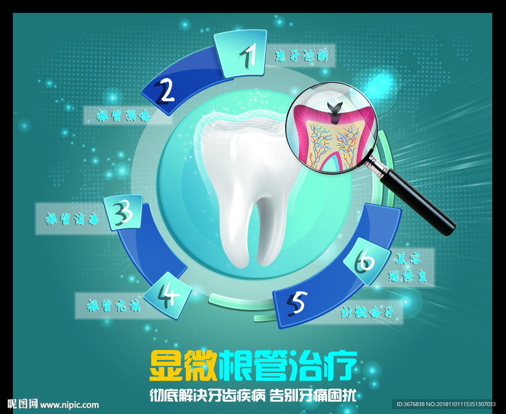 显微根管治疗