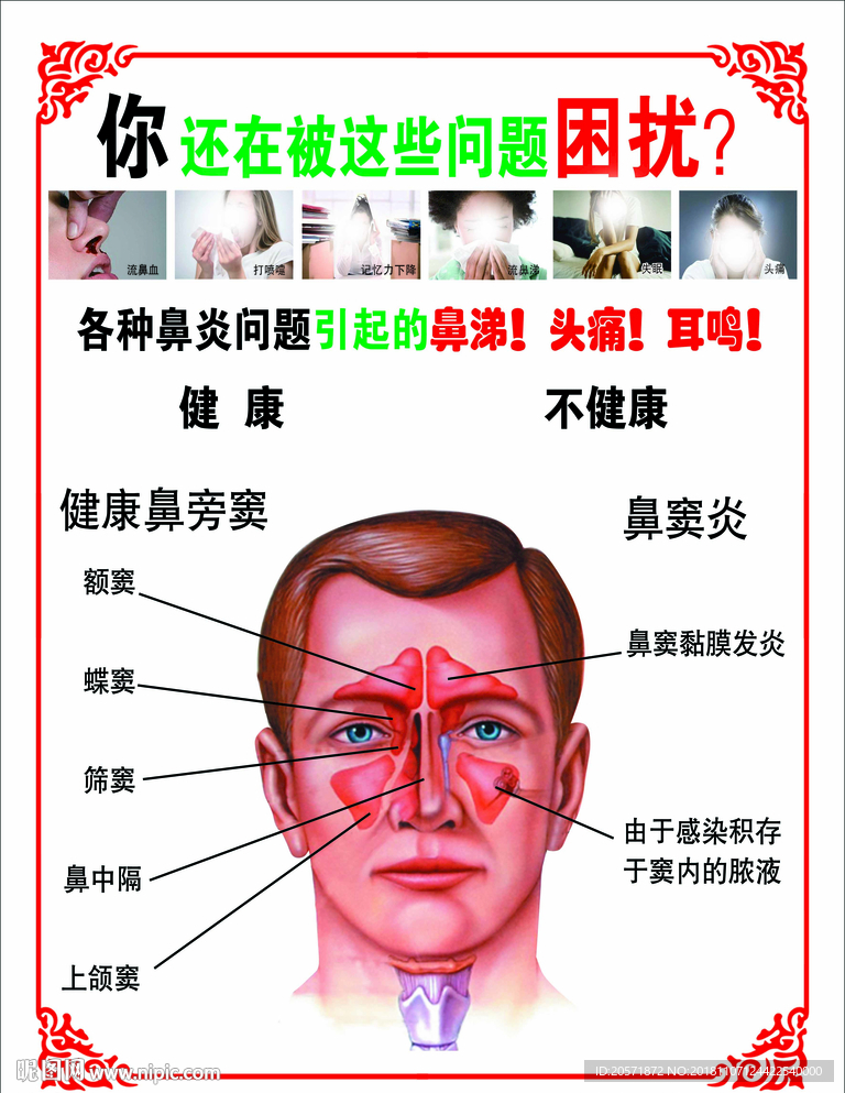 鼻炎海报