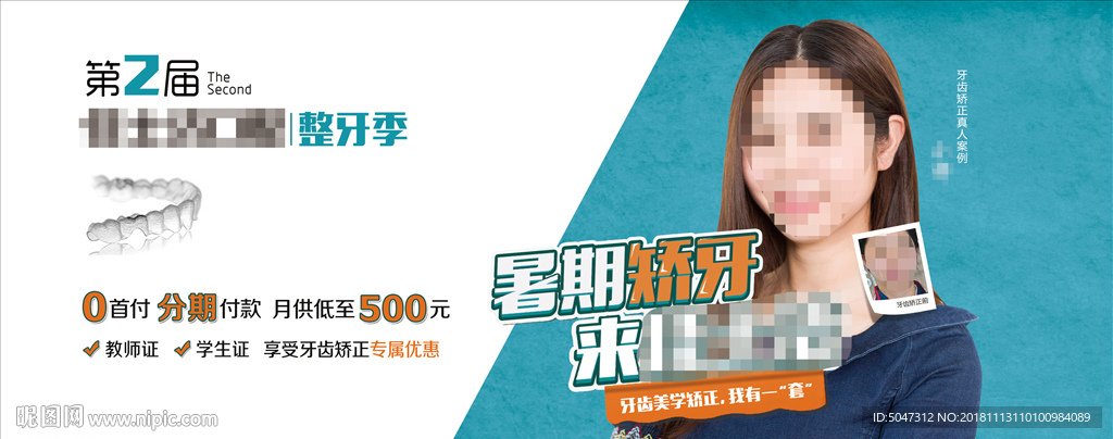 牙齿矫正