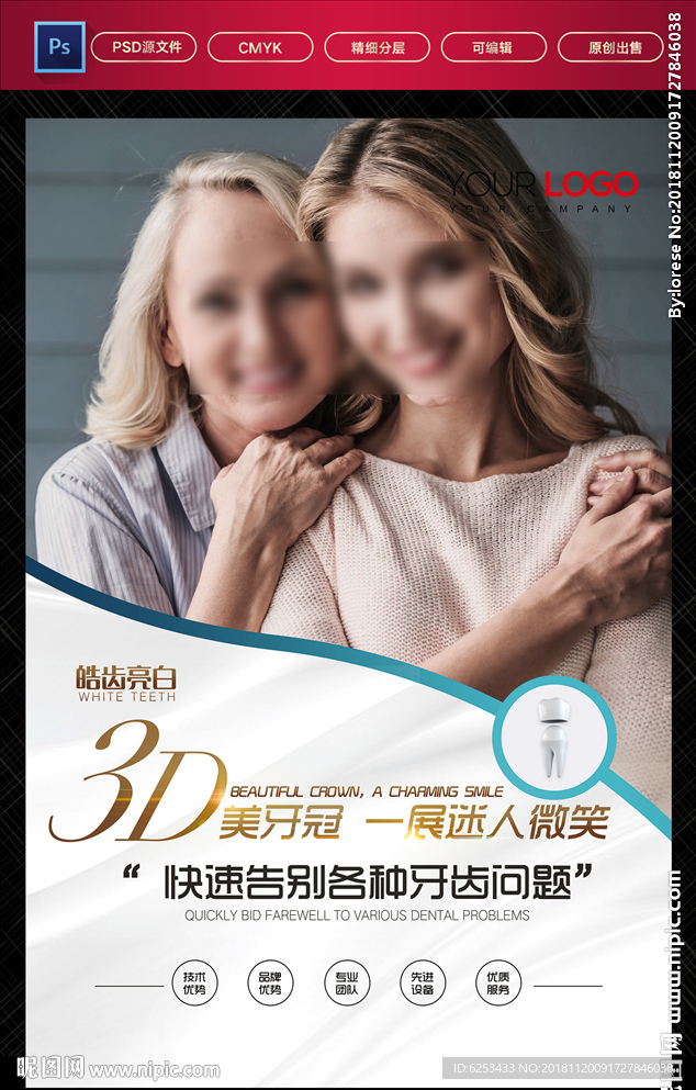 美牙冠