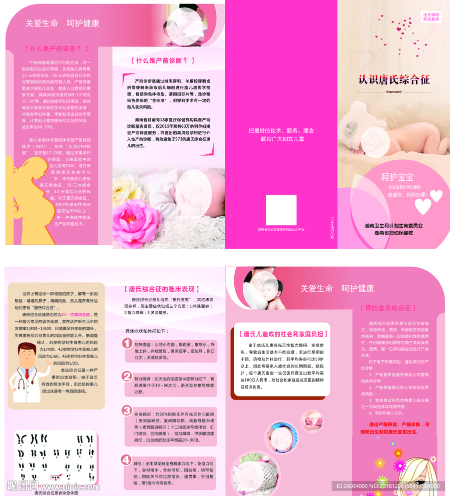 母婴唐氏综合症