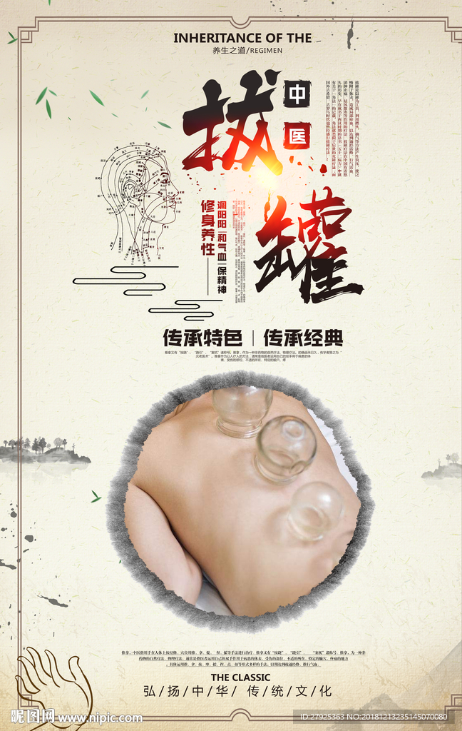 拔罐