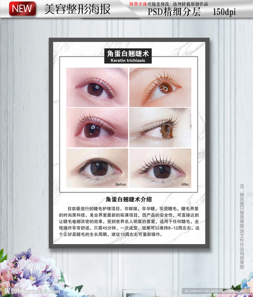 角蛋白翘睫术