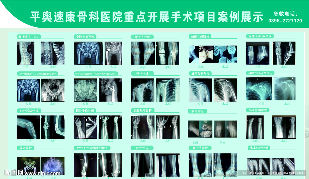 骨科医院案例
