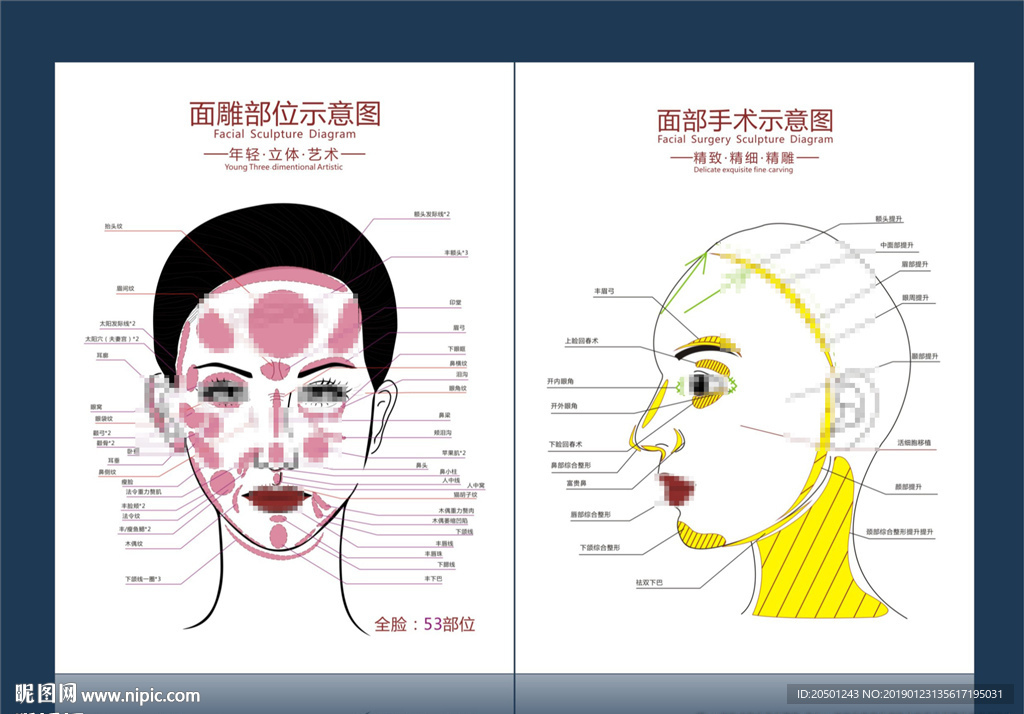 整形面部手术示意图