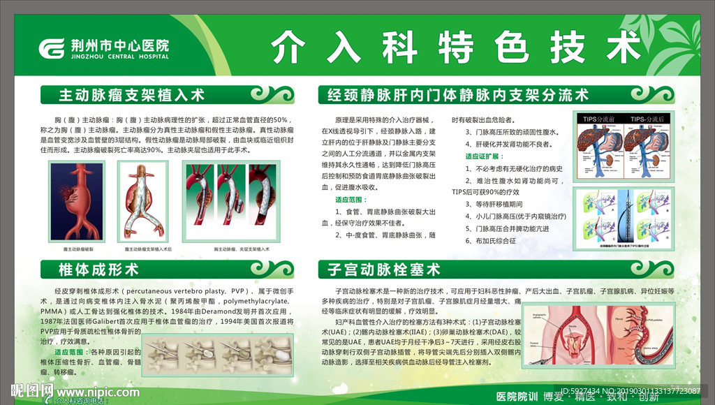 介入科特色技术