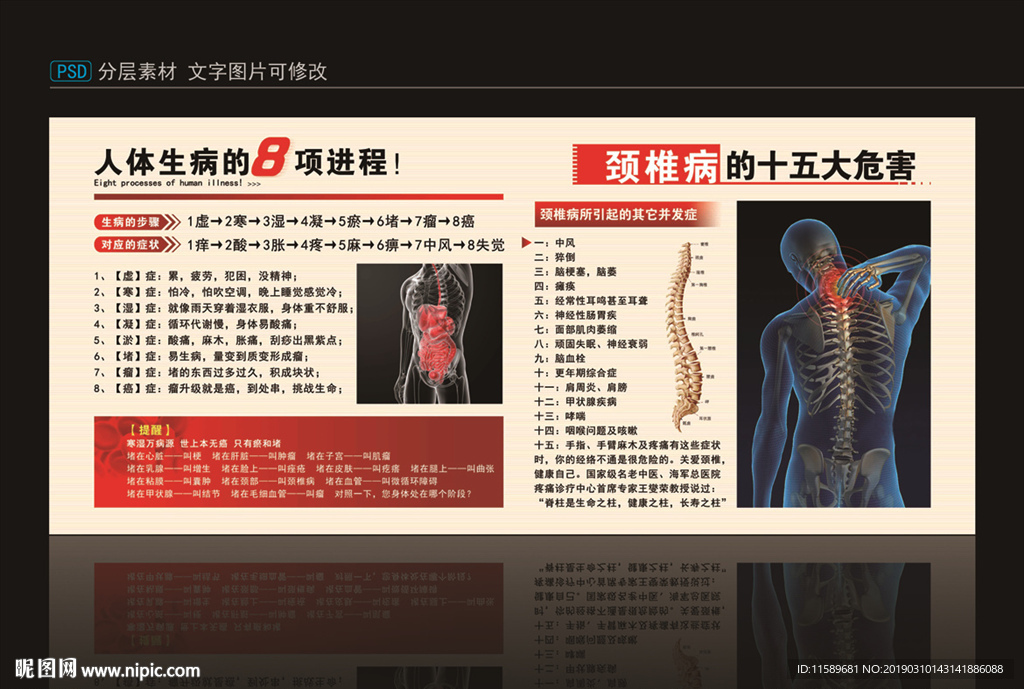 颈椎病 生病8项进程设计图