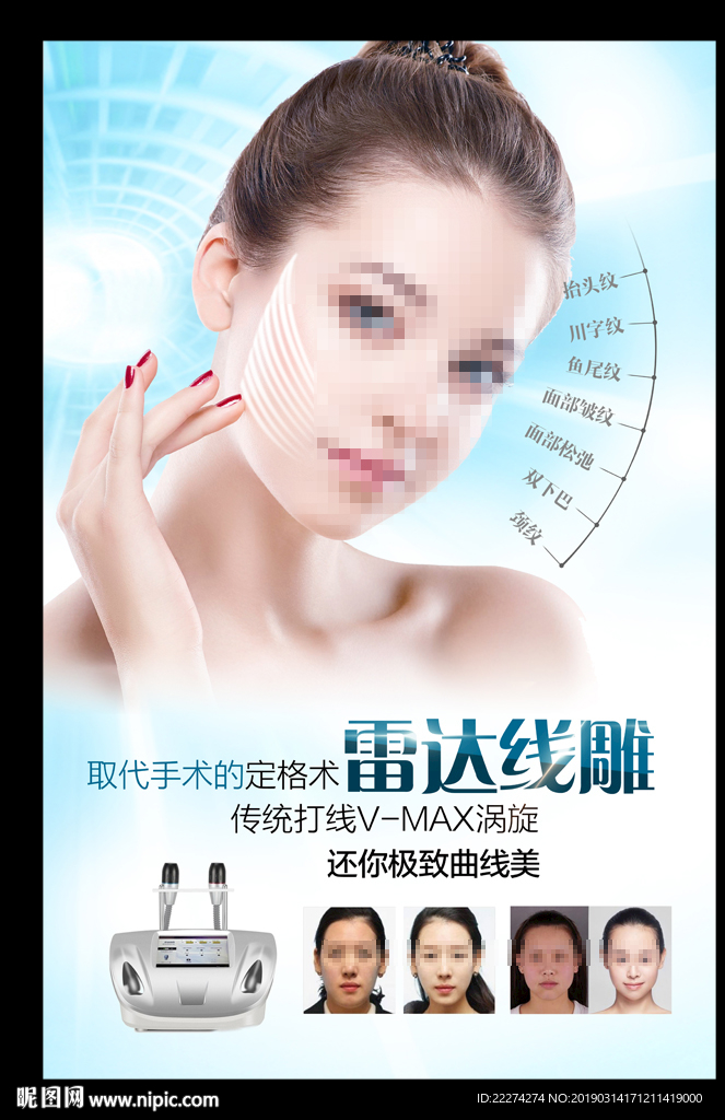 雷达线雕