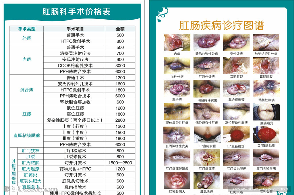 肛肠疾病诊疗科室解剖图谱