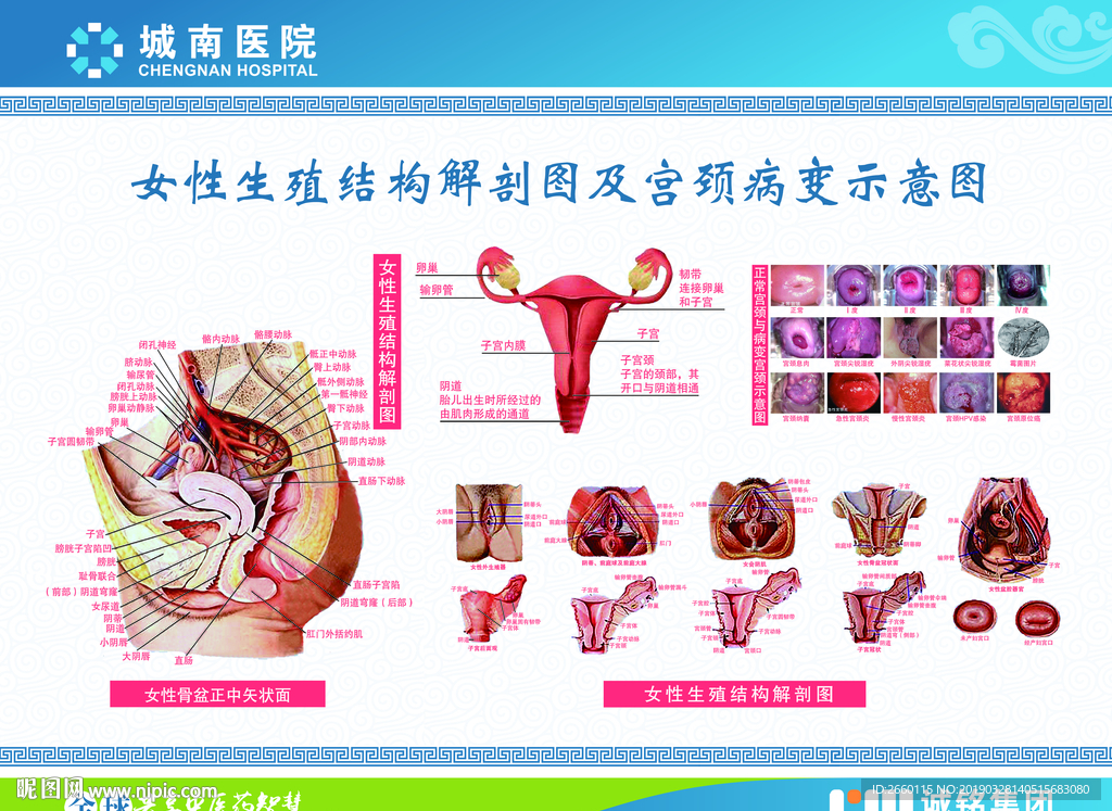 医院妇科子宫图