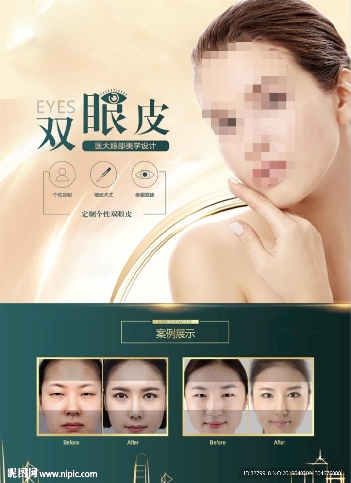 眼部整形