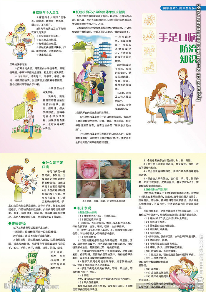 手足口病防治