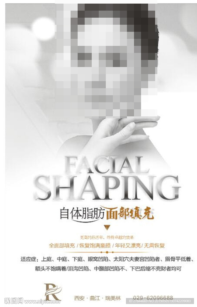 自体脂肪 面部填充