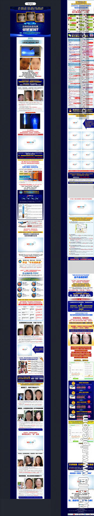 色斑 祛斑 科技美容 美白 页