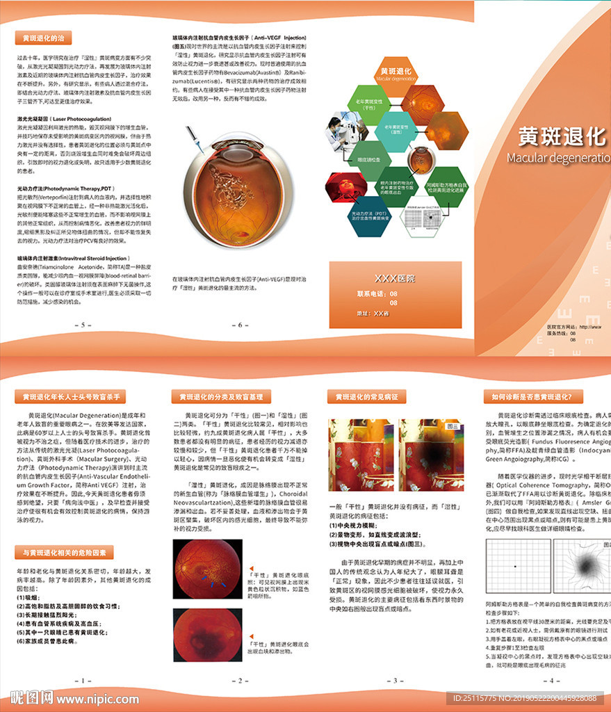 黄斑退货折页