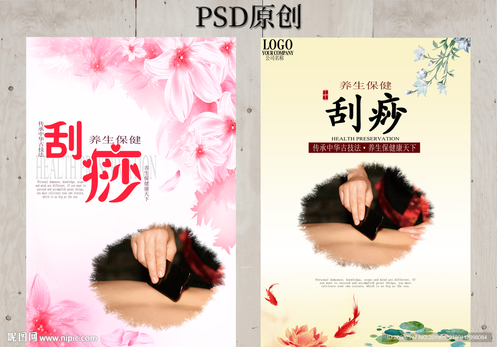 刮痧