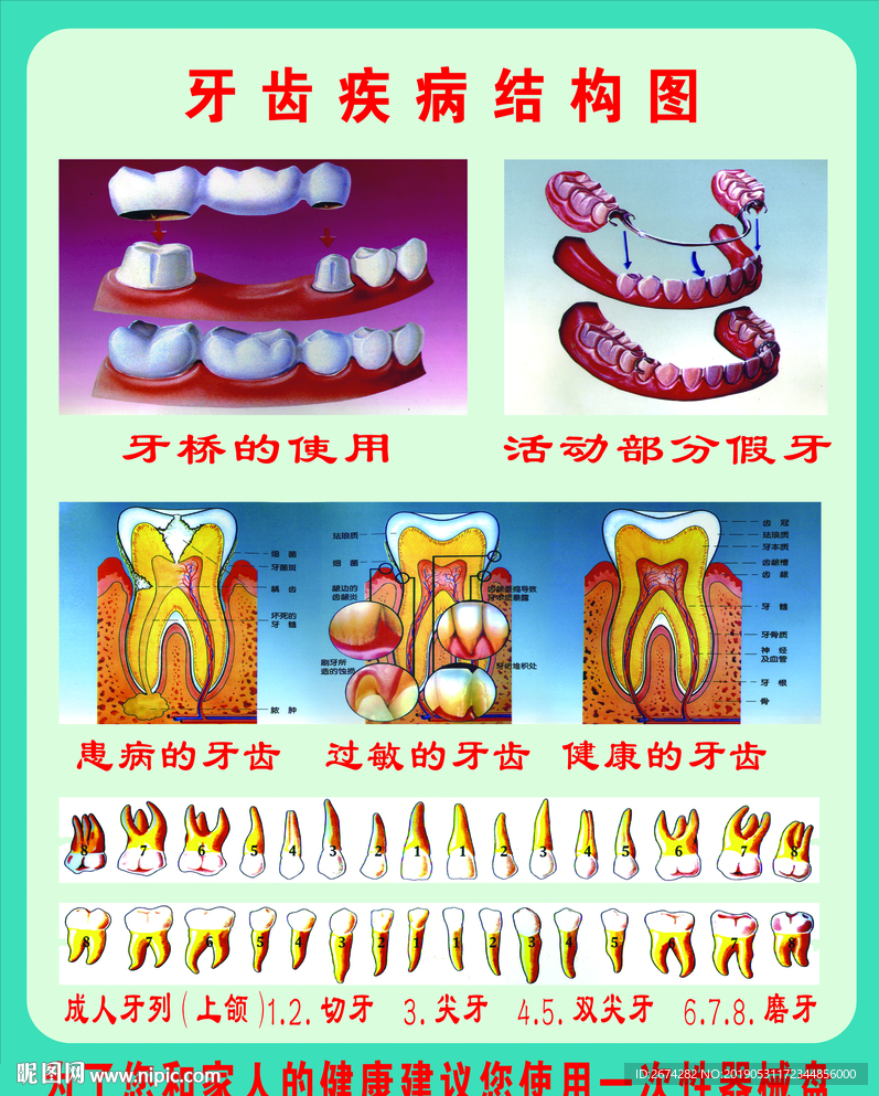 牙齿疾病结构图