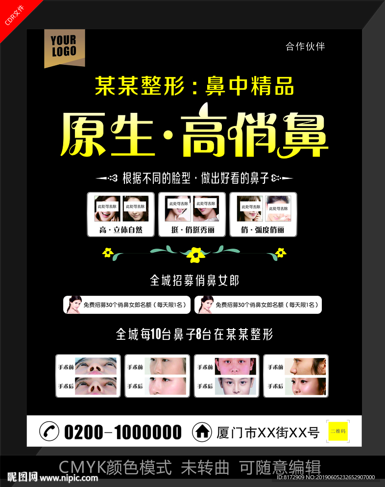 俏鼻整形