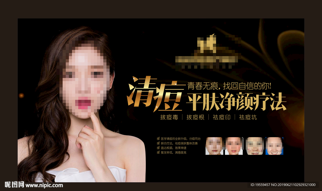 美容专业祛痘