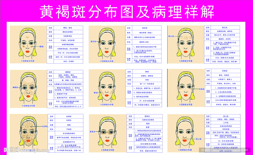 黄褐斑分布图