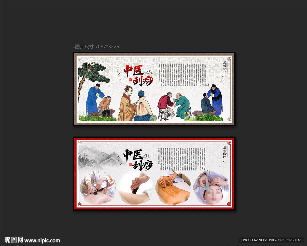 刮痧