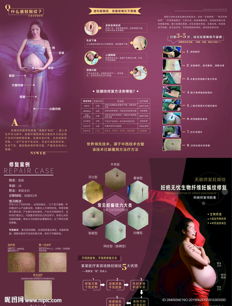 医疗整形妊辰纹三折页