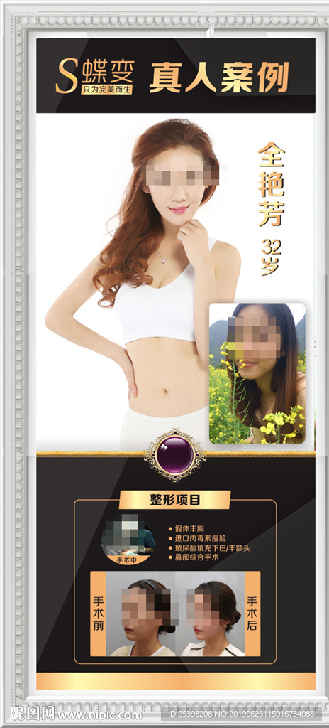 眼部鼻部隆丰唇瘦脸整形案