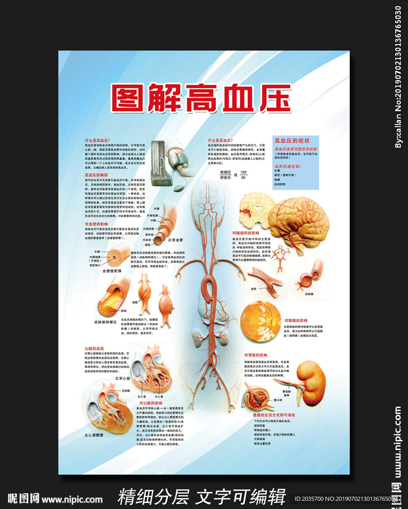 图解高血压