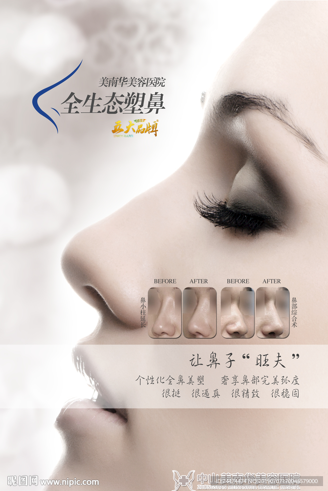 隆鼻