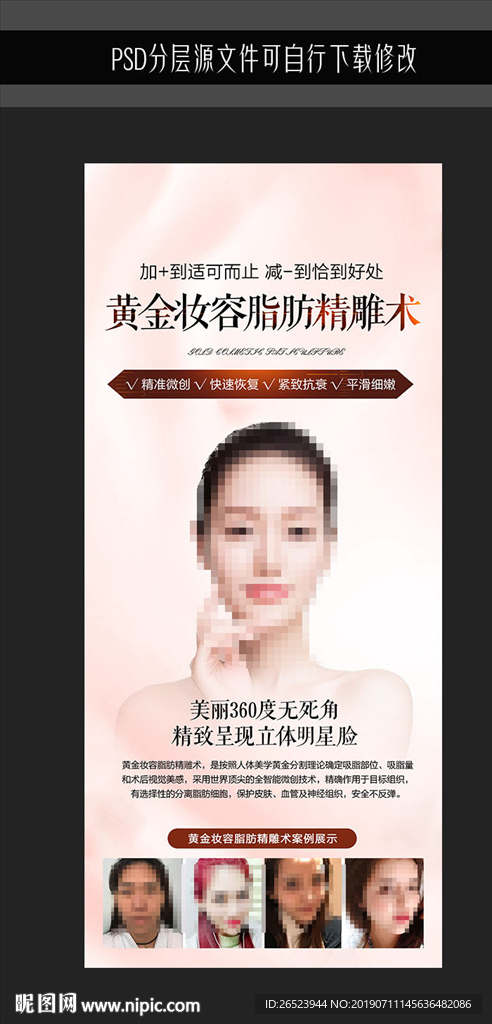 面部脂肪填充